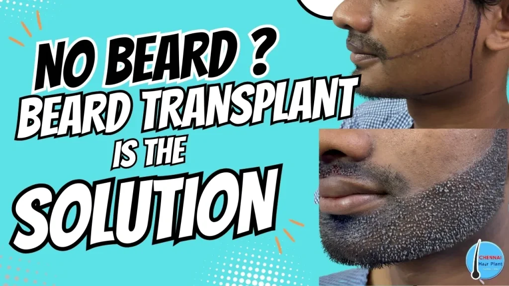 No Beard ? Don’t worry we have a solution !