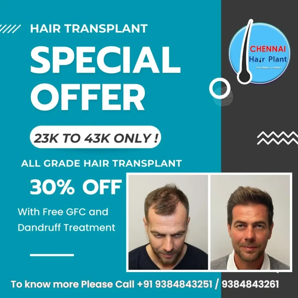 Hurray ! Special Offer !