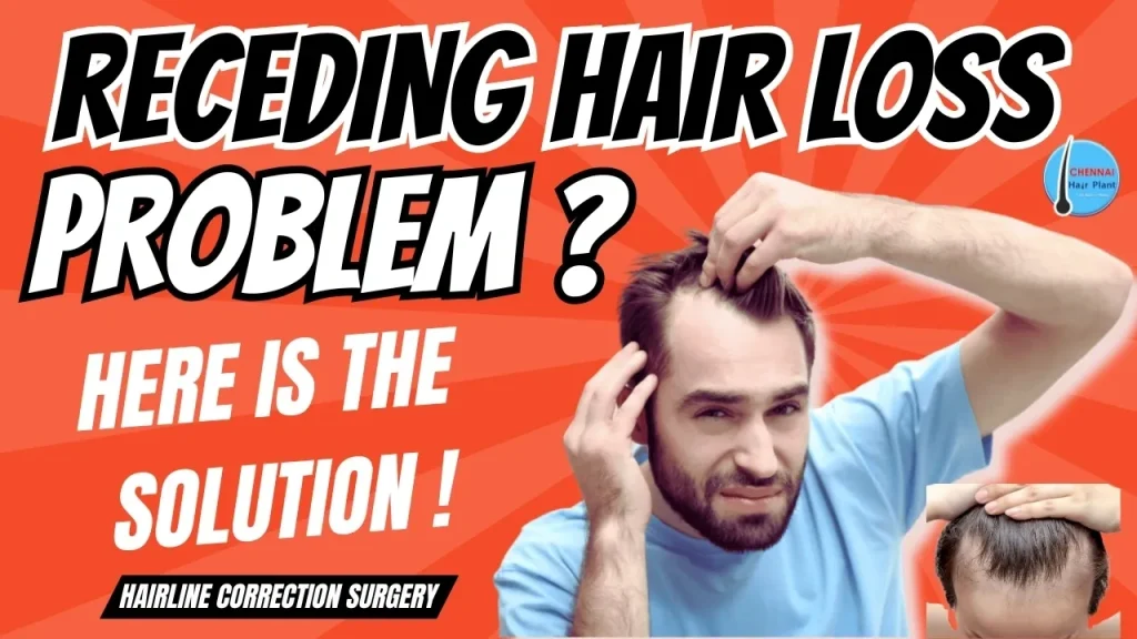 Receding hair loss problem ? male pattern baldness